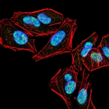 PLC gamma 2 Mouse Monoclonal Antibody