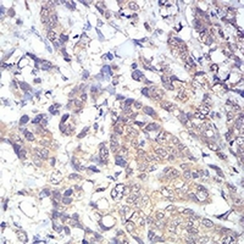 PLC gamma 1 Mouse Monoclonal Antibody