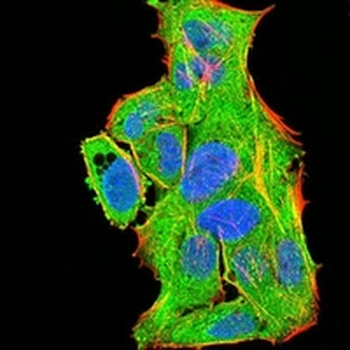 PLC gamma 1 Mouse Monoclonal Antibody