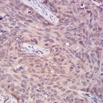 PLC gamma 1 Mouse Monoclonal Antibody