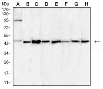 uPA Mouse Monoclonal Antibody