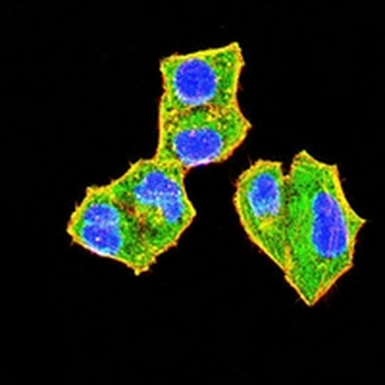 uPA Mouse Monoclonal Antibody