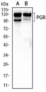 Progesterone Receptor Mouse Monoclonal Antibody
