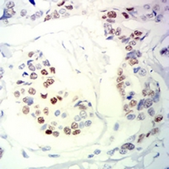Progesterone Receptor Mouse Monoclonal Antibody