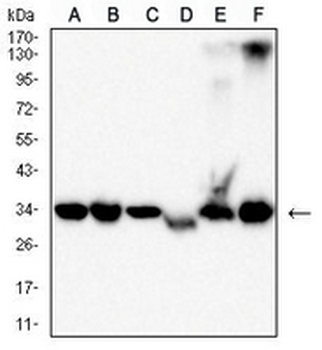Pyridoxal Kinase Mouse Monoclonal Antibody