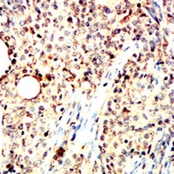 Pyridoxal Kinase Mouse Monoclonal Antibody