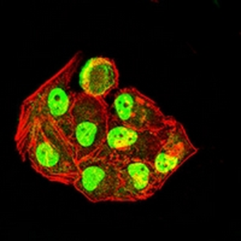 Pyridoxal Kinase Mouse Monoclonal Antibody