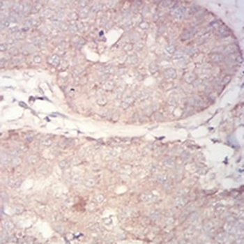 PDPK1 Mouse Monoclonal Antibody