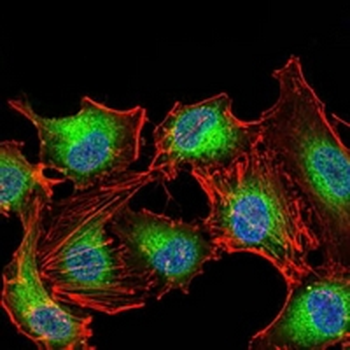 PDPK1 Mouse Monoclonal Antibody