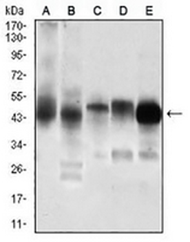 PDK2 Mouse Monoclonal Antibody