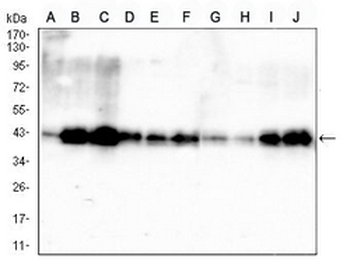 PDHA1 Mouse Monoclonal Antibody