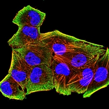 CD273 Mouse Monoclonal Antibody