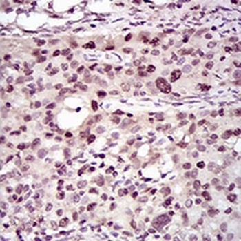 PCNA Mouse Monoclonal Antibody