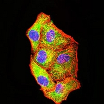 PCK2 Mouse Monoclonal Antibody