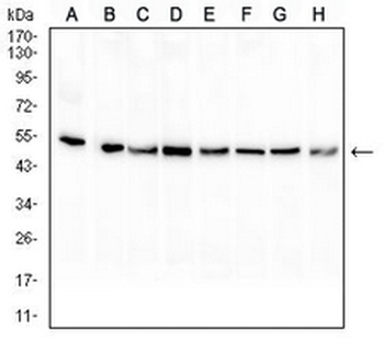 PAX8 Mouse Monoclonal Antibody