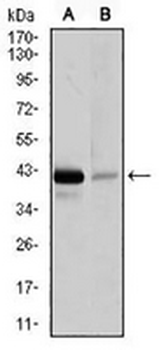PAX5 Mouse Monoclonal Antibody
