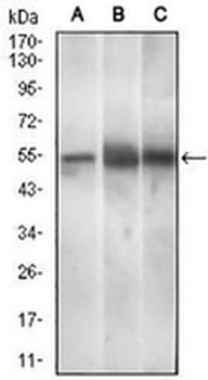 PAX3 Mouse Monoclonal Antibody