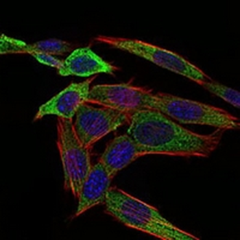PAPLN Mouse Monoclonal Antibody