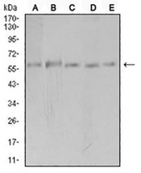 PAK3 Mouse Monoclonal Antibody