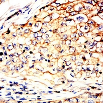 PDI Mouse Monoclonal Antibody