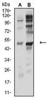 P2Y12 Mouse Monoclonal Antibody