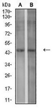 P2Y1 Mouse Monoclonal Antibody