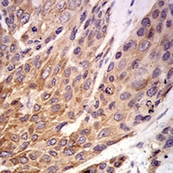 P2RX7 Mouse Monoclonal Antibody