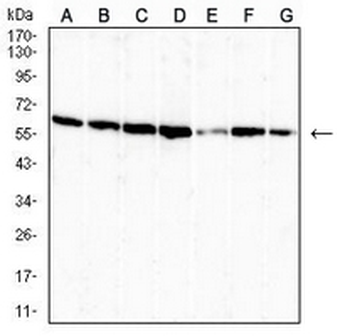 OTUB2 Mouse Monoclonal Antibody