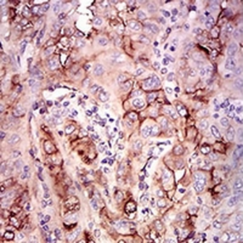 CD73 Mouse Monoclonal Antibody