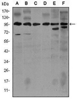 iNOS Mouse Monoclonal Antibody