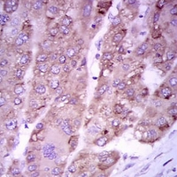 iNOS Mouse Monoclonal Antibody