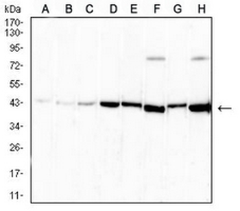 Neuroglobin Mouse Monoclonal Antibody