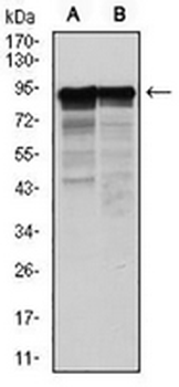 NEFL Mouse Monoclonal Antibody