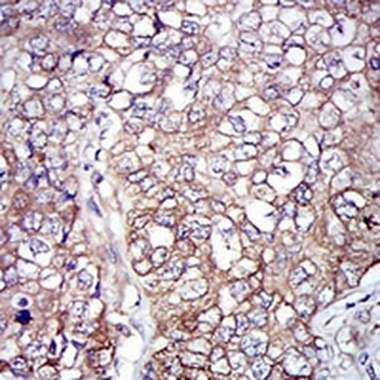 NEFL Mouse Monoclonal Antibody