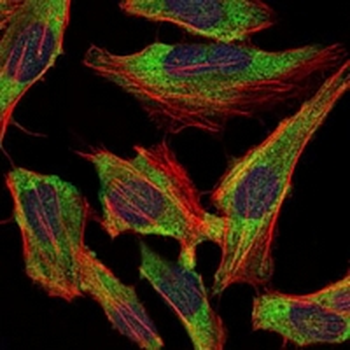 NEFL Mouse Monoclonal Antibody