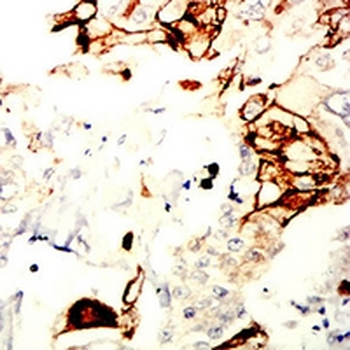NDC80 Mouse Monoclonal Antibody