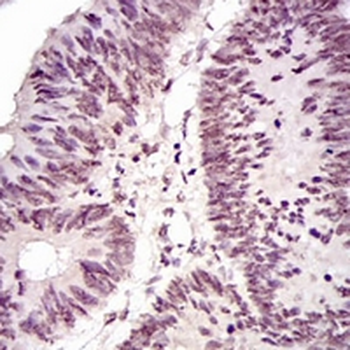 NCK1 Mouse Monoclonal Antibody