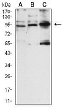 CD56 Mouse Monoclonal Antibody