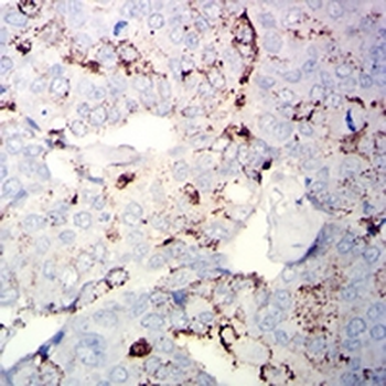 CD56 Mouse Monoclonal Antibody