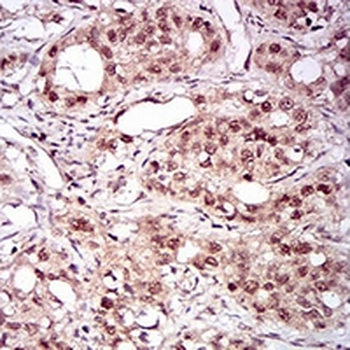 Nibrin Mouse Monoclonal Antibody