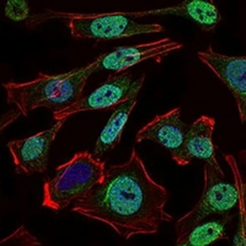 Nibrin Mouse Monoclonal Antibody