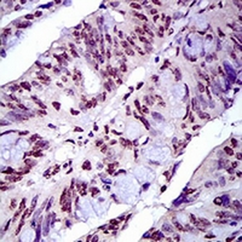 Napsin A Mouse Monoclonal Antibody