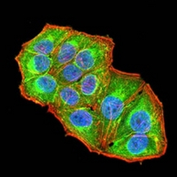 ARD1 Mouse Monoclonal Antibody