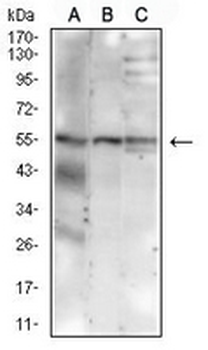 MUC13 Mouse Monoclonal Antibody