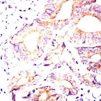 MUC13 Mouse Monoclonal Antibody