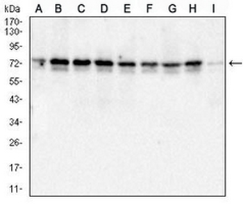 Metadherin Mouse Monoclonal Antibody