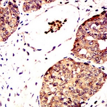 Metadherin Mouse Monoclonal Antibody