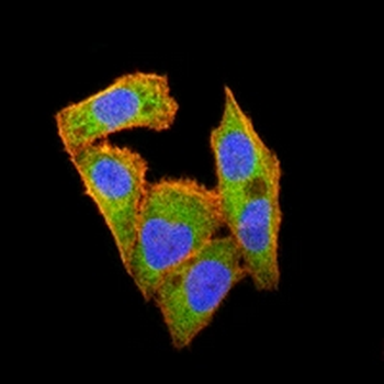 Metadherin Mouse Monoclonal Antibody