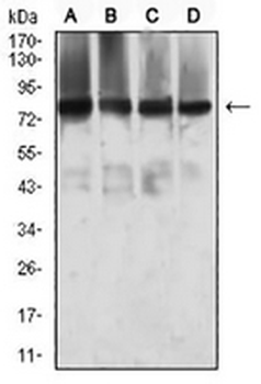 MTA1 Mouse Monoclonal Antibody