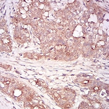 GDF8 Mouse Monoclonal Antibody